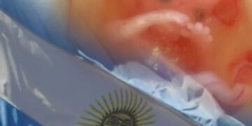 Argentina fue el primer país en conmemorar el Día del Niño por Nacer