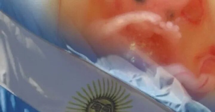 Argentina fue el primer país en conmemorar el Día del Niño por Nacer