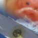 Argentina fue el primer país en conmemorar el Día del Niño por Nacer