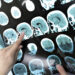 Nuevas pistas para la identificación temprana de Alzheimer