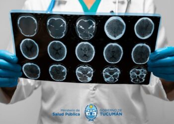 Cómo detectar un ACV y qué hacer ante la emergencia: Claves para actuar a tiempo