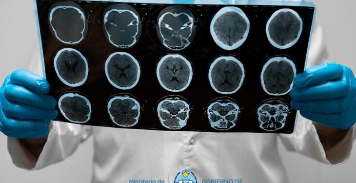 Cómo detectar un ACV y qué hacer ante la emergencia: Claves para actuar a tiempo