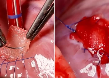 Crean un parche cardíaco biológico impreso en 3D para el corazón