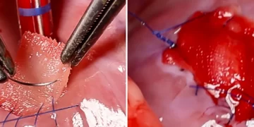 Crean un parche cardíaco biológico impreso en 3D para el corazón
