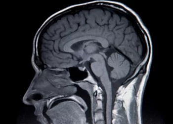 Implante cerebral permite a un hombre con ELA hablar y cantar con su “voz real”