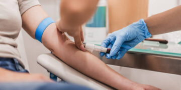 Un análisis de sangre promete detectar el párkinson antes de los primeros síntomas