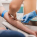 Un análisis de sangre promete detectar el párkinson antes de los primeros síntomas